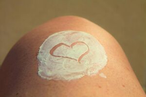 日焼け後の色素沈着を防ぐためのスキンケア方法は？